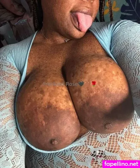 Freckledfantasy5